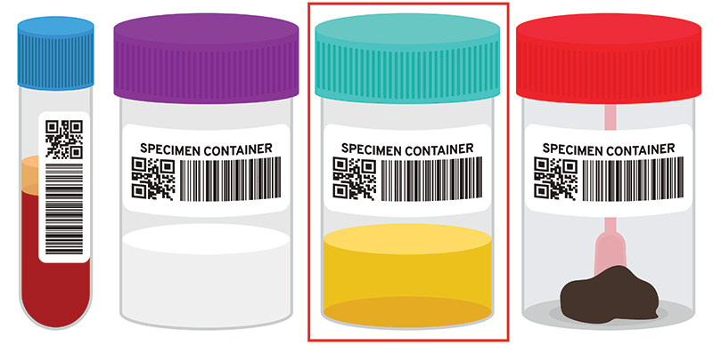  types de tests de dépistage des drogues, le test urinaire étant le plus important 